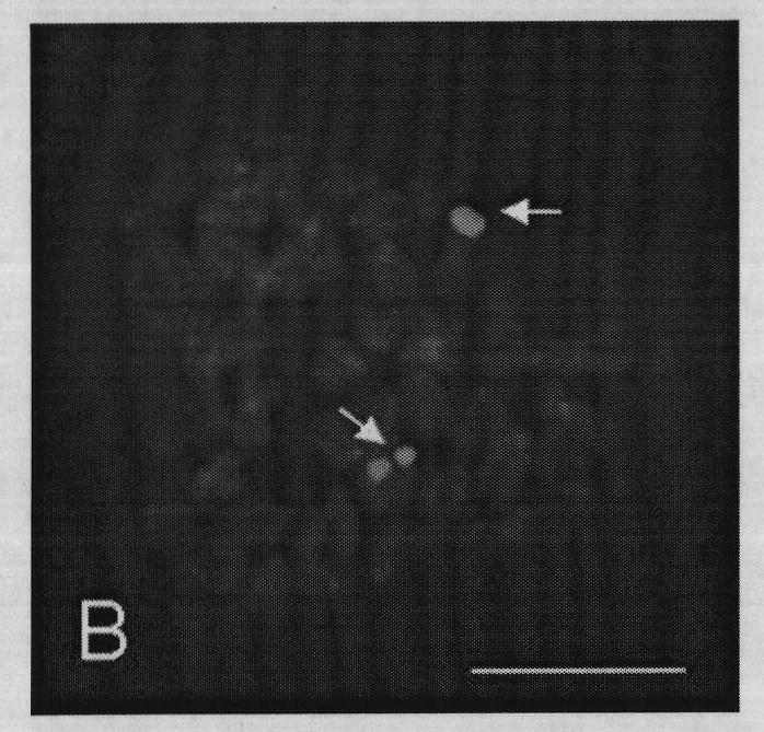 Fluorescence in situ hybridization (FISH) method for fish chromosomes