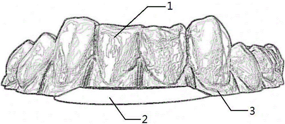 Teeth model and method for preparing concealed correcting device by utilizing model