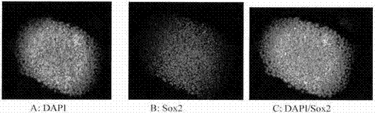 Preparation method of immobilized all-anthropogenic ECM coating matrix