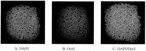 Preparation method of immobilized all-anthropogenic ECM coating matrix