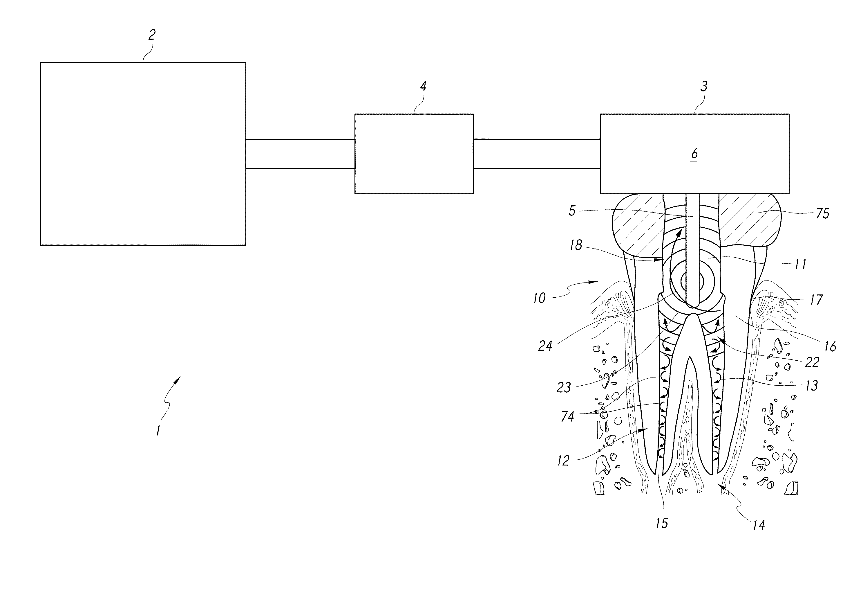 Apparatus and methods for filling teeth and root canals