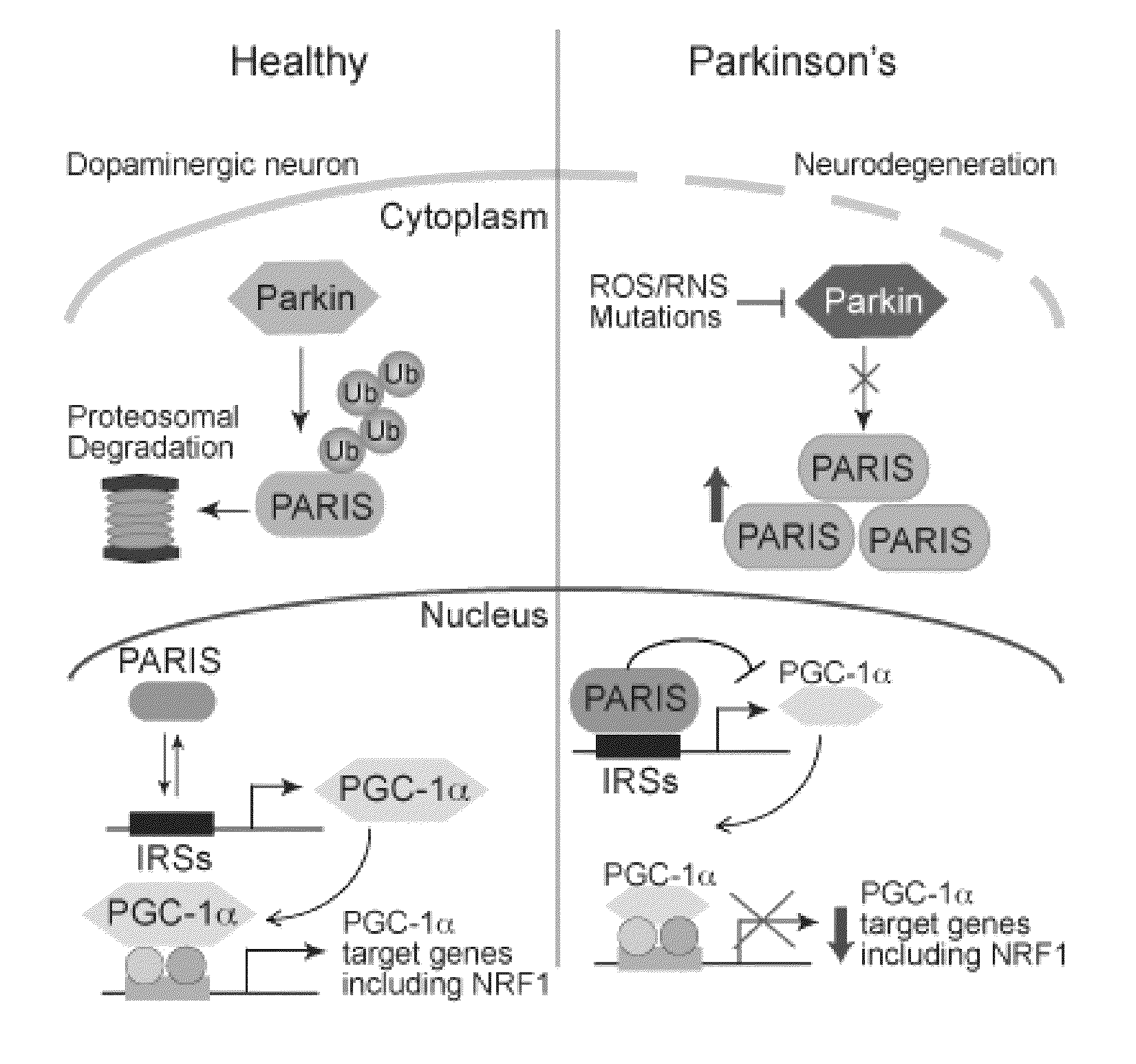 Transcriptional repression leading to Parkinson's disease