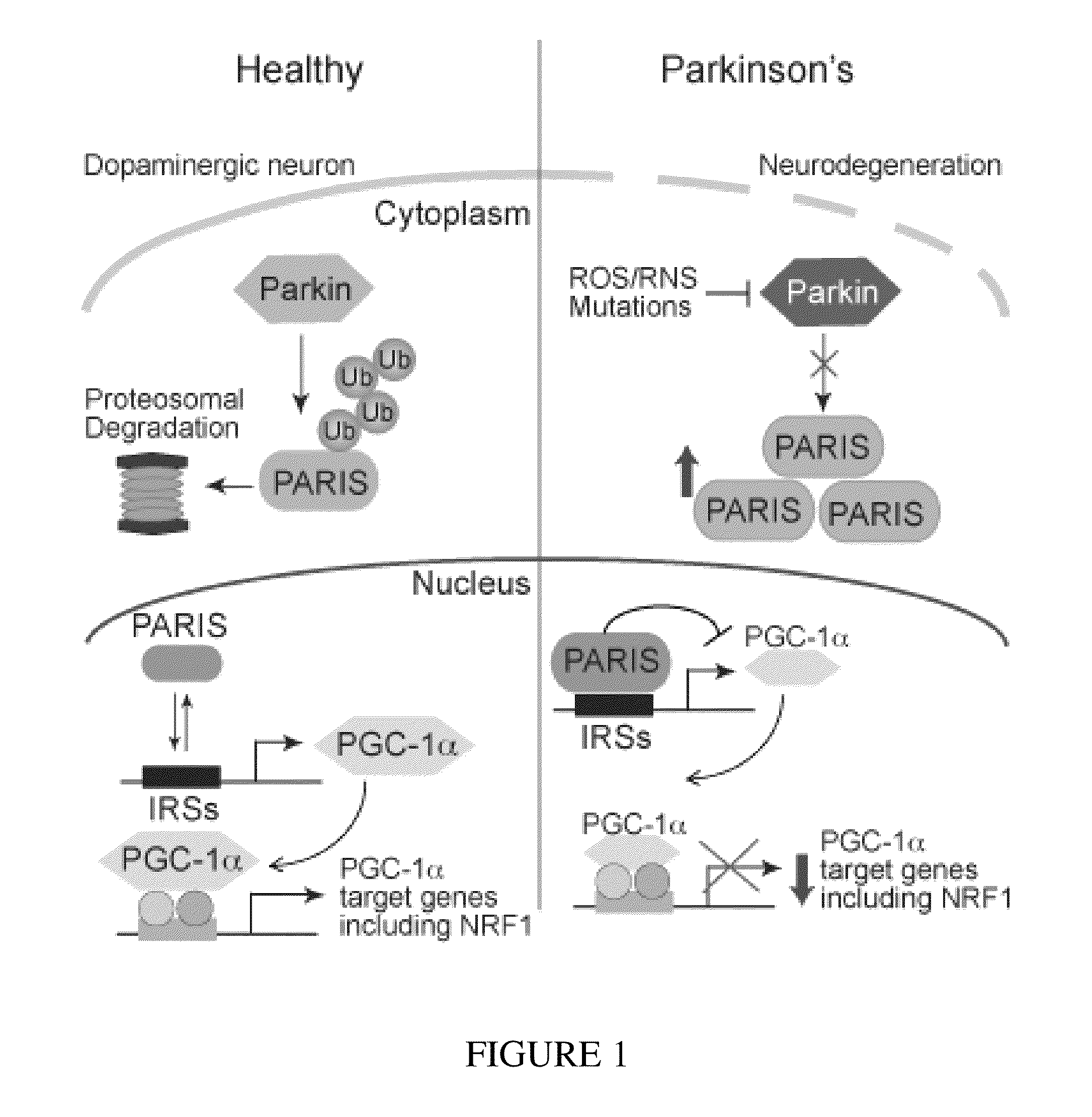 Transcriptional repression leading to Parkinson's disease