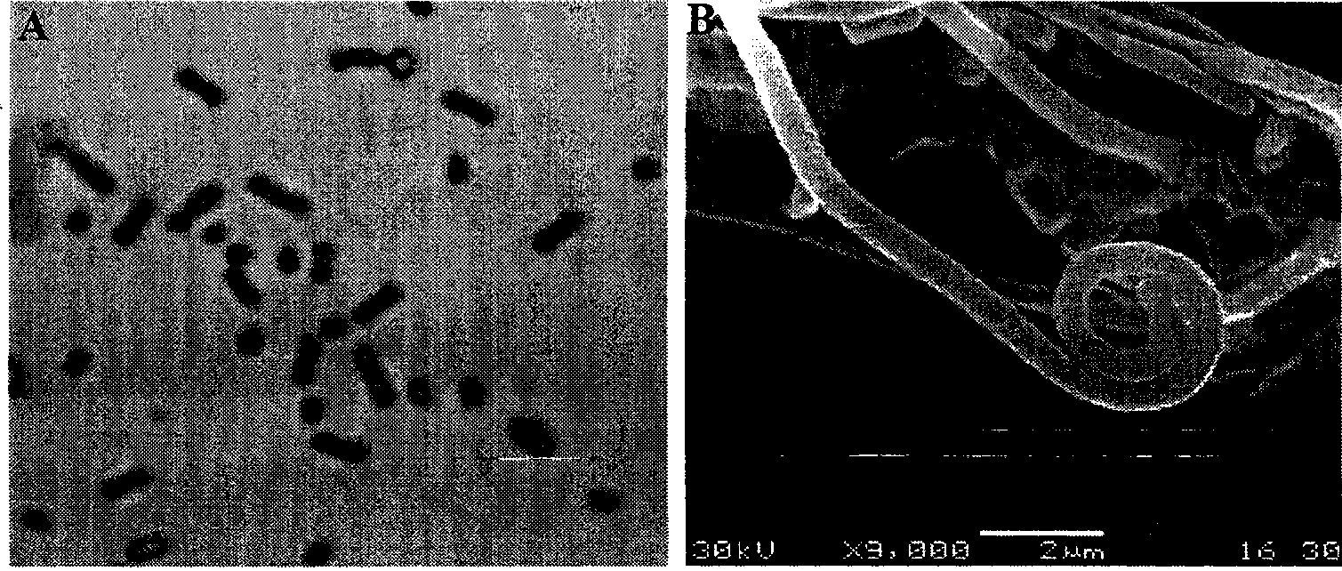 Preparation and use of lilac grey streptomycete and active product thereof