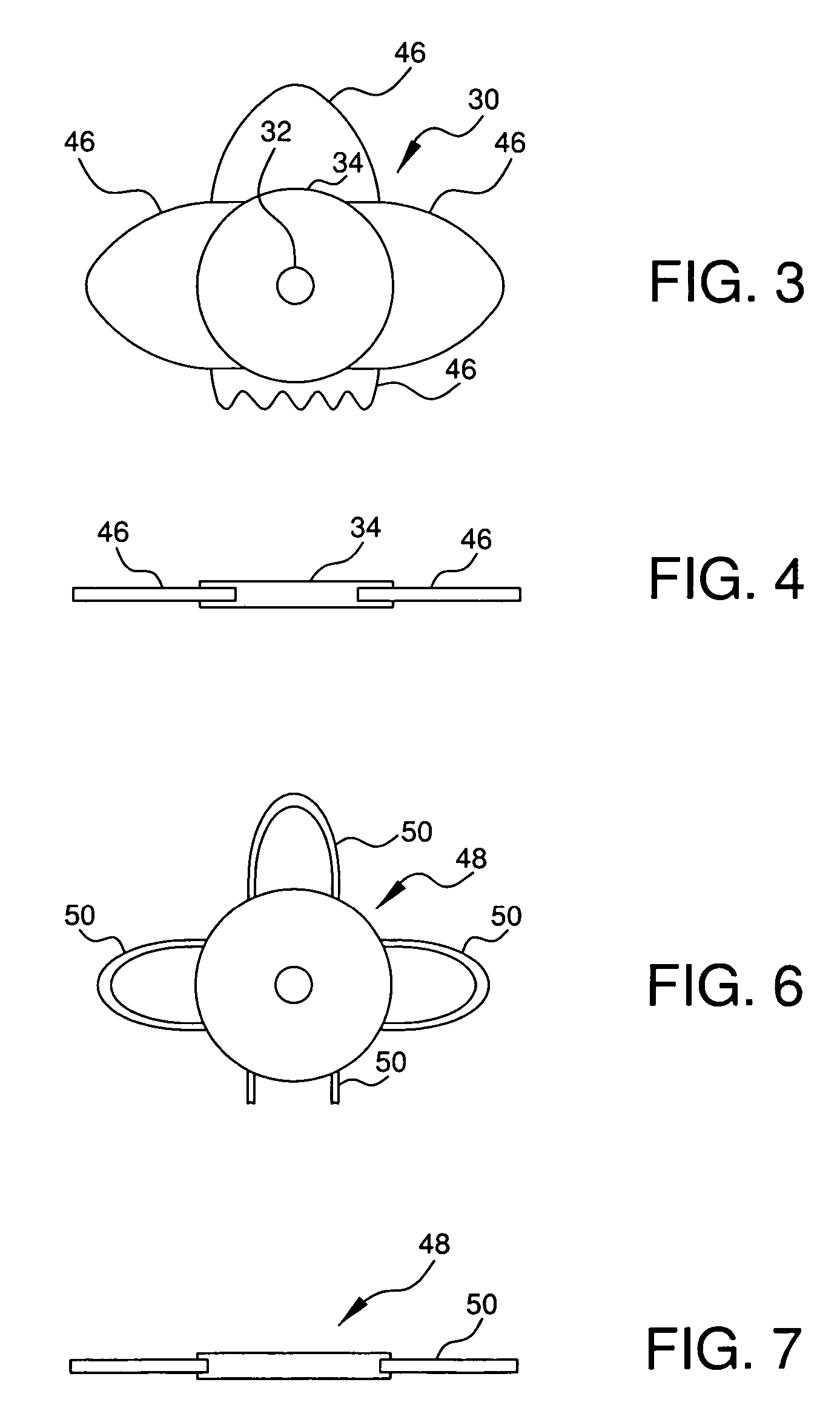 Bifocal intraocular telescope for low vision correction