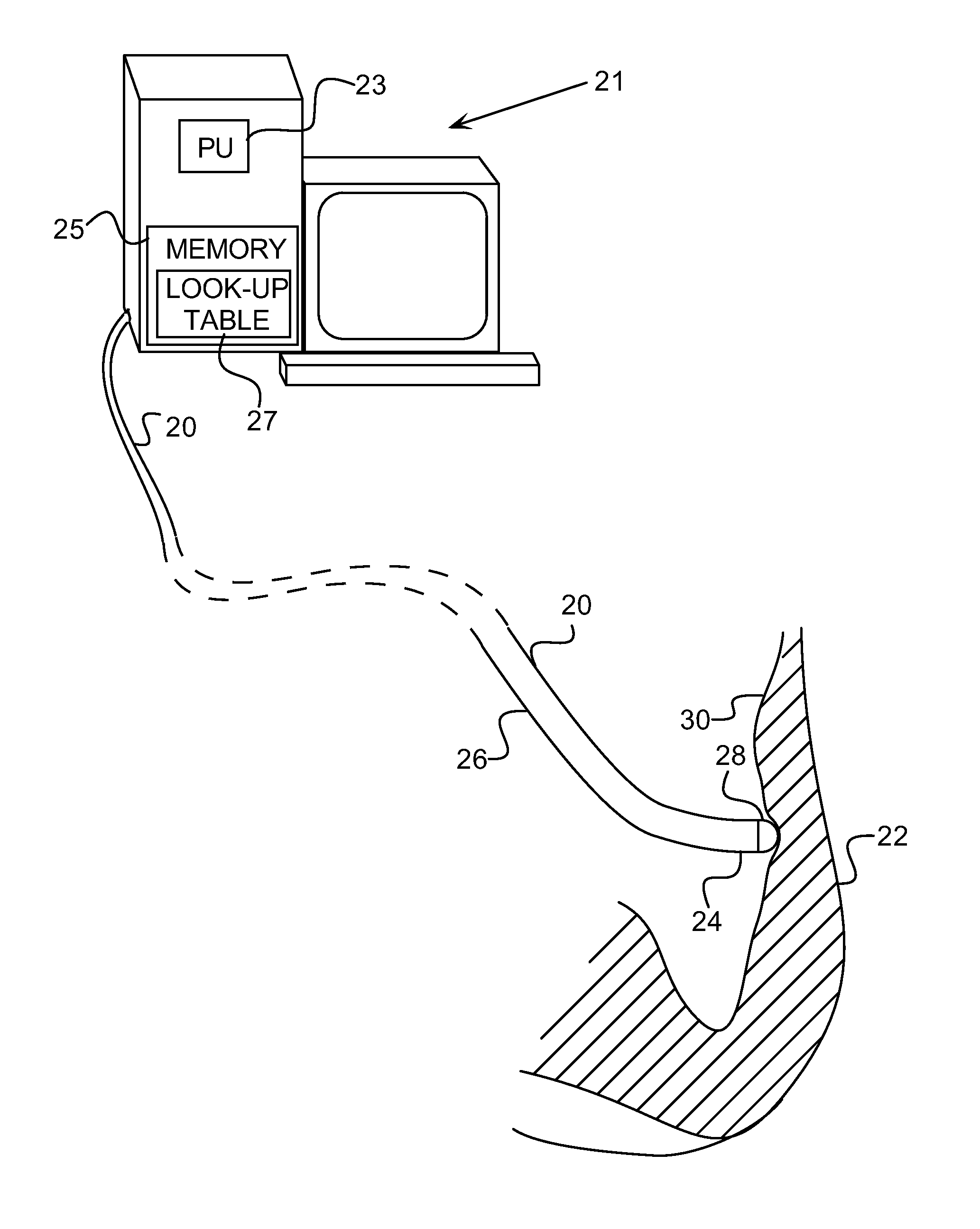 Catheter with strain gauge sensor