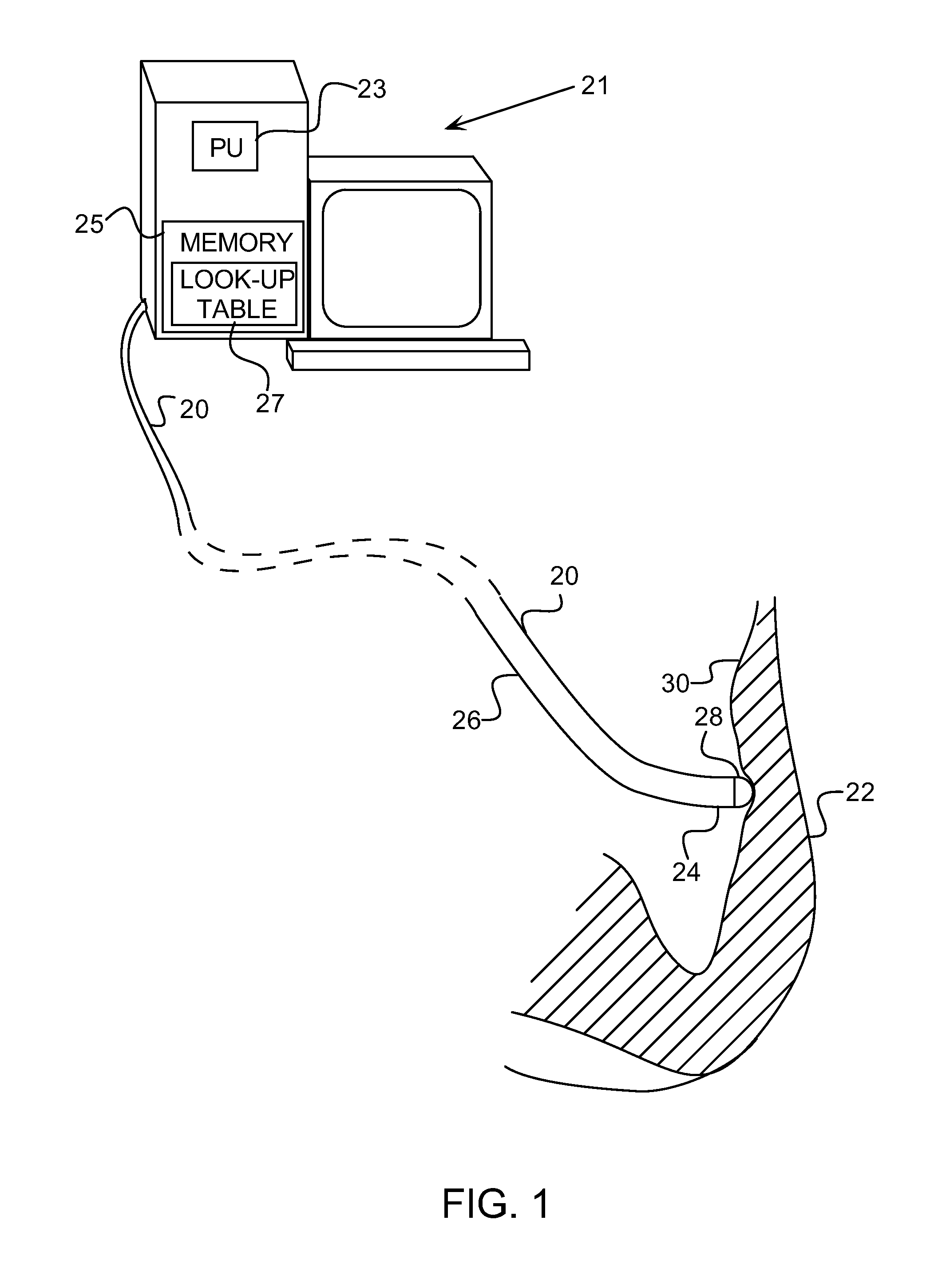 Catheter with strain gauge sensor