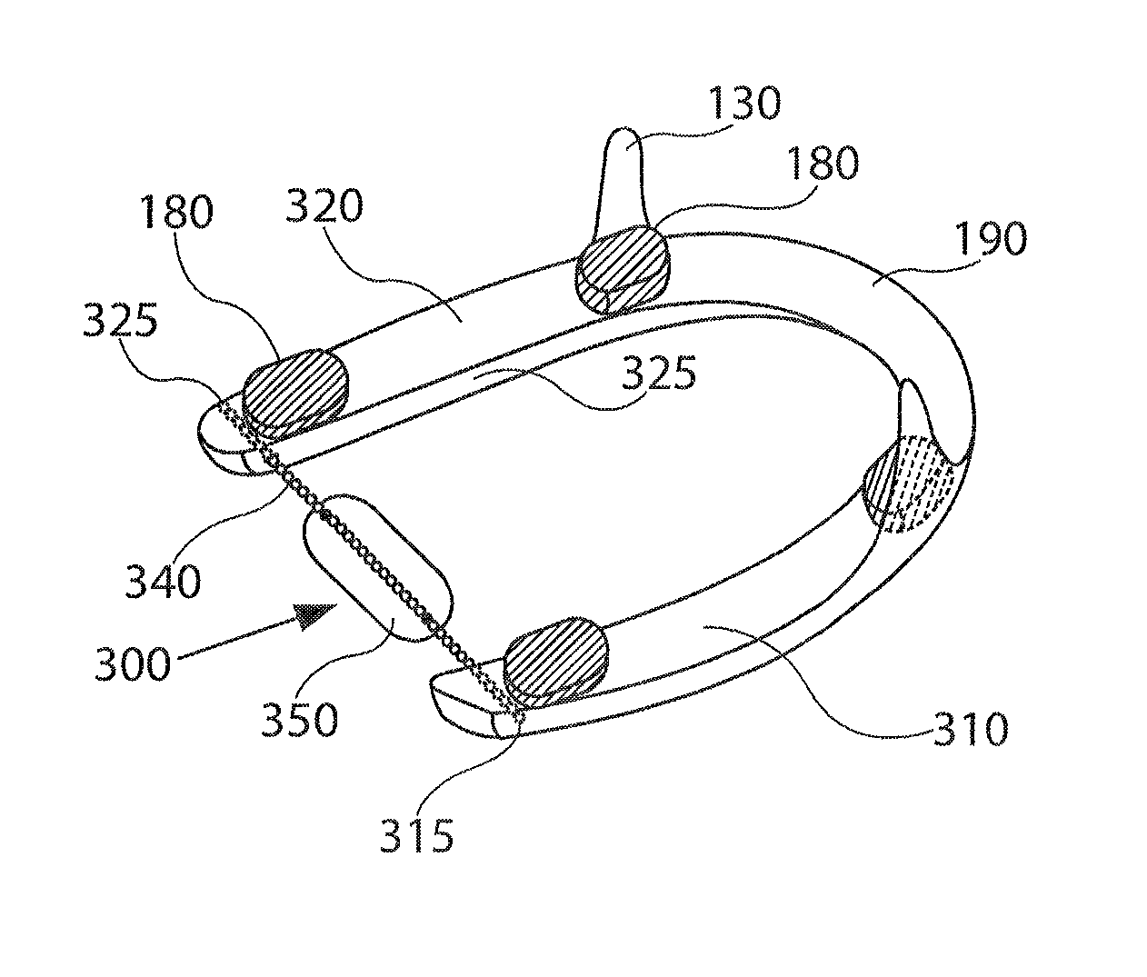 Mandibular advancement device