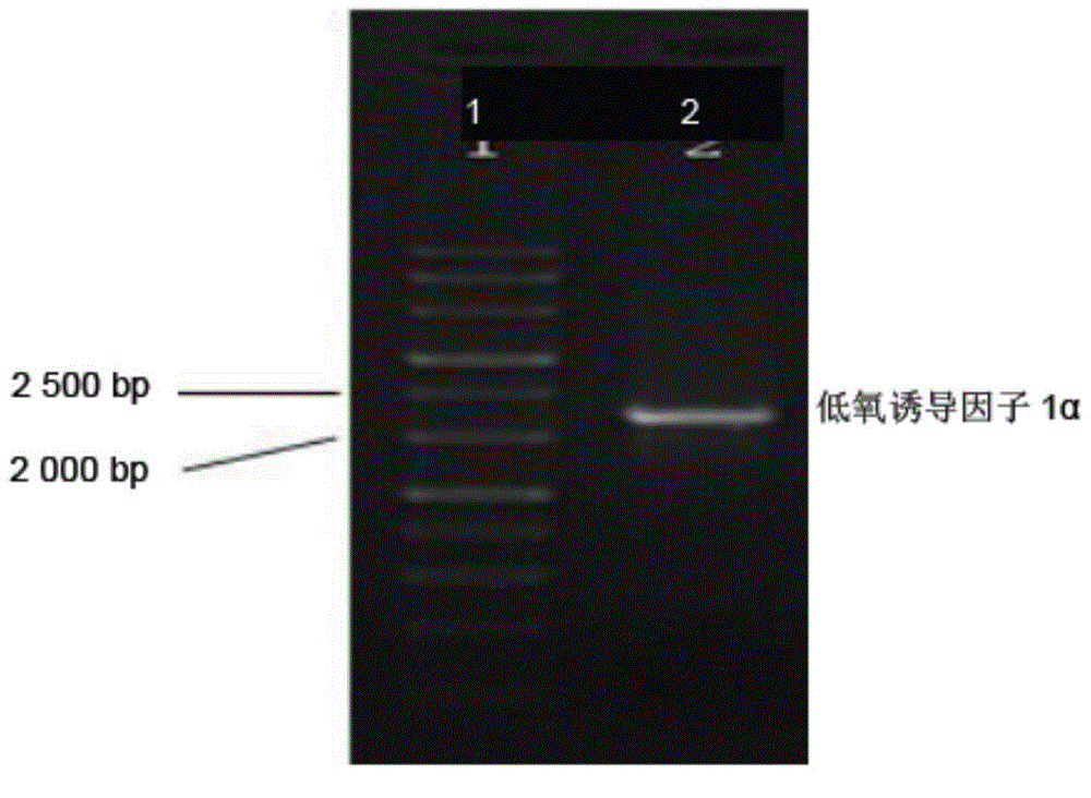 A constructing method of a bone marrow stem cell expressing an osteogenic gene