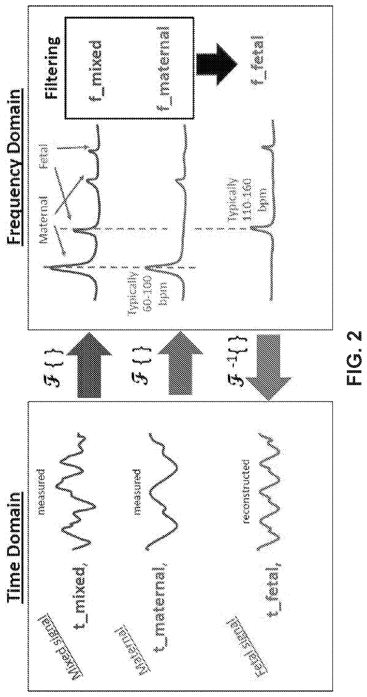 Robust, clinical-grade transabdominal fetal pulse oximetry