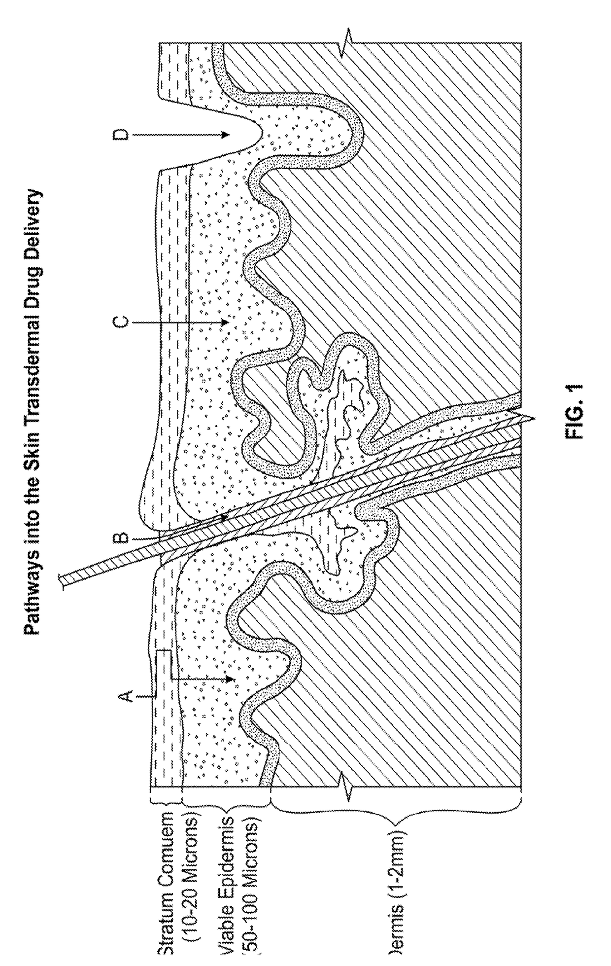 Enhanced transdermal delivery of active agents