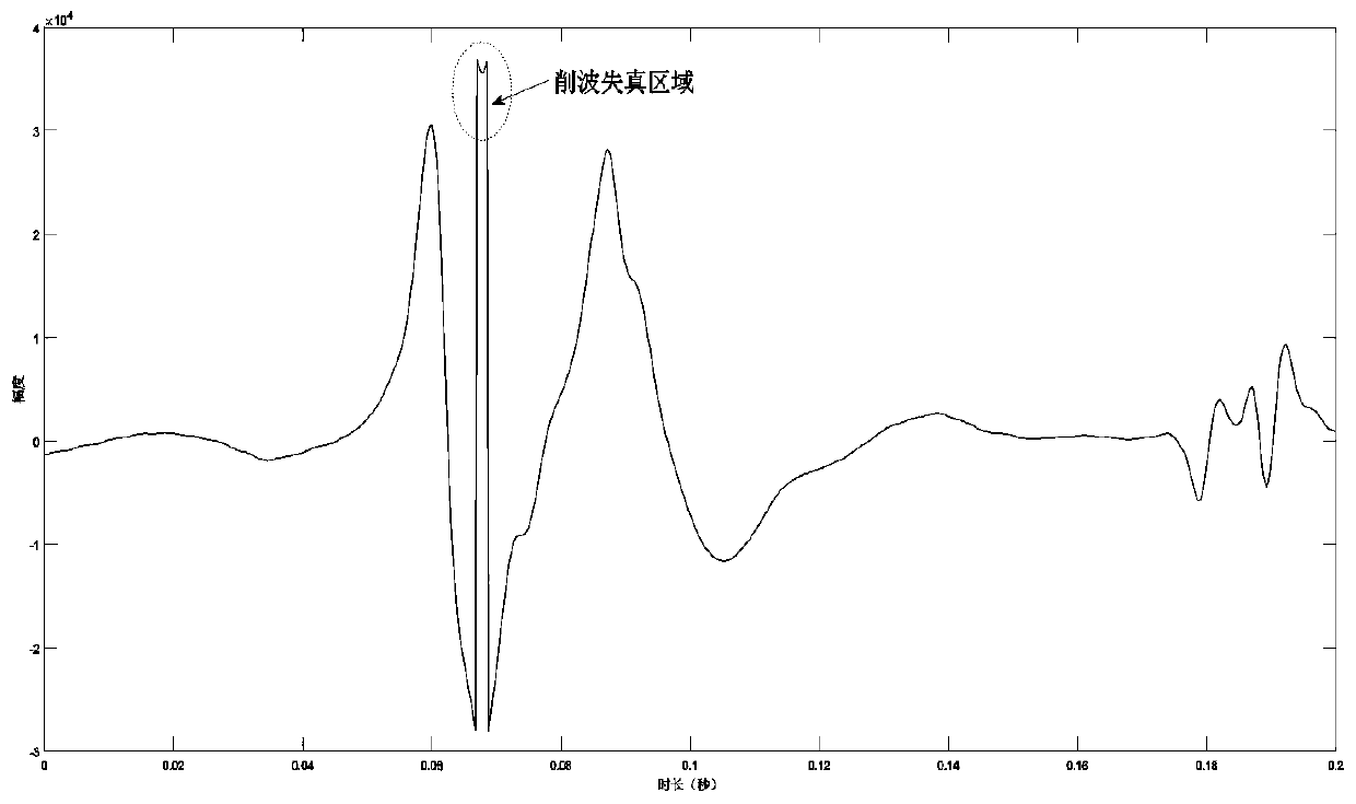 Method for automatically positioning and repairing clipping distortion waveforms of electronic stethoscope