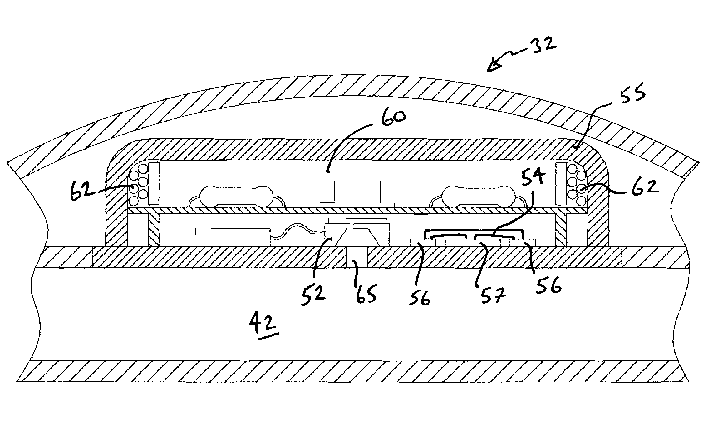 Combined Pressure and Flow Sensor Integrated in a Shunt System