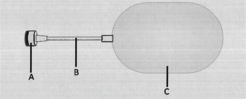 A tissue expander with an external valve