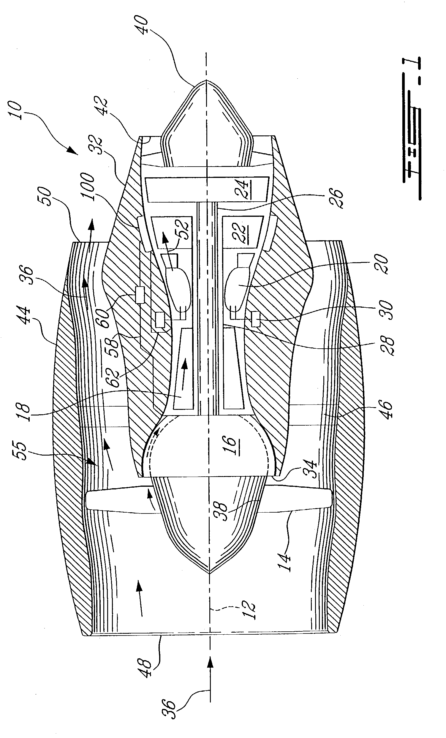 Hybrid turbine tip clearance control system