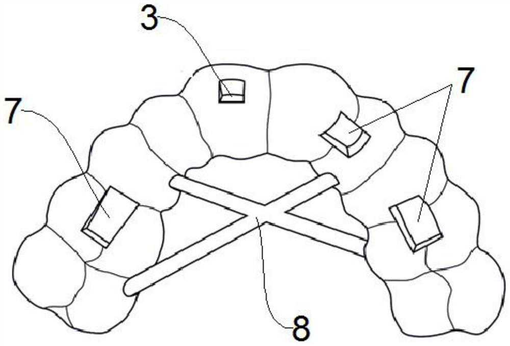 A kind of manufacturing method of residual root residual crown post-core plastic repair guide plate and guide plate