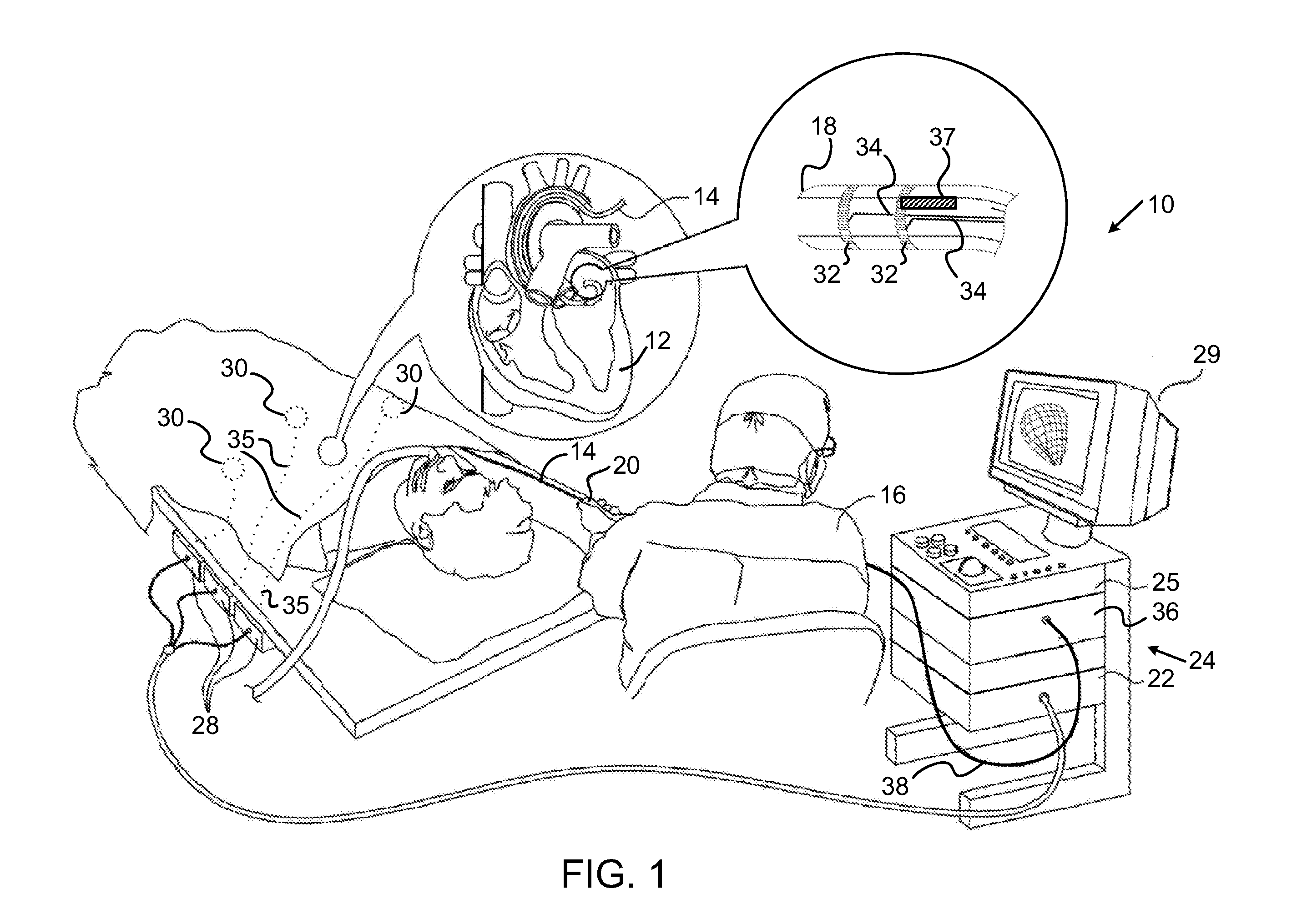 System for controlling tissue ablation using temperature sensors