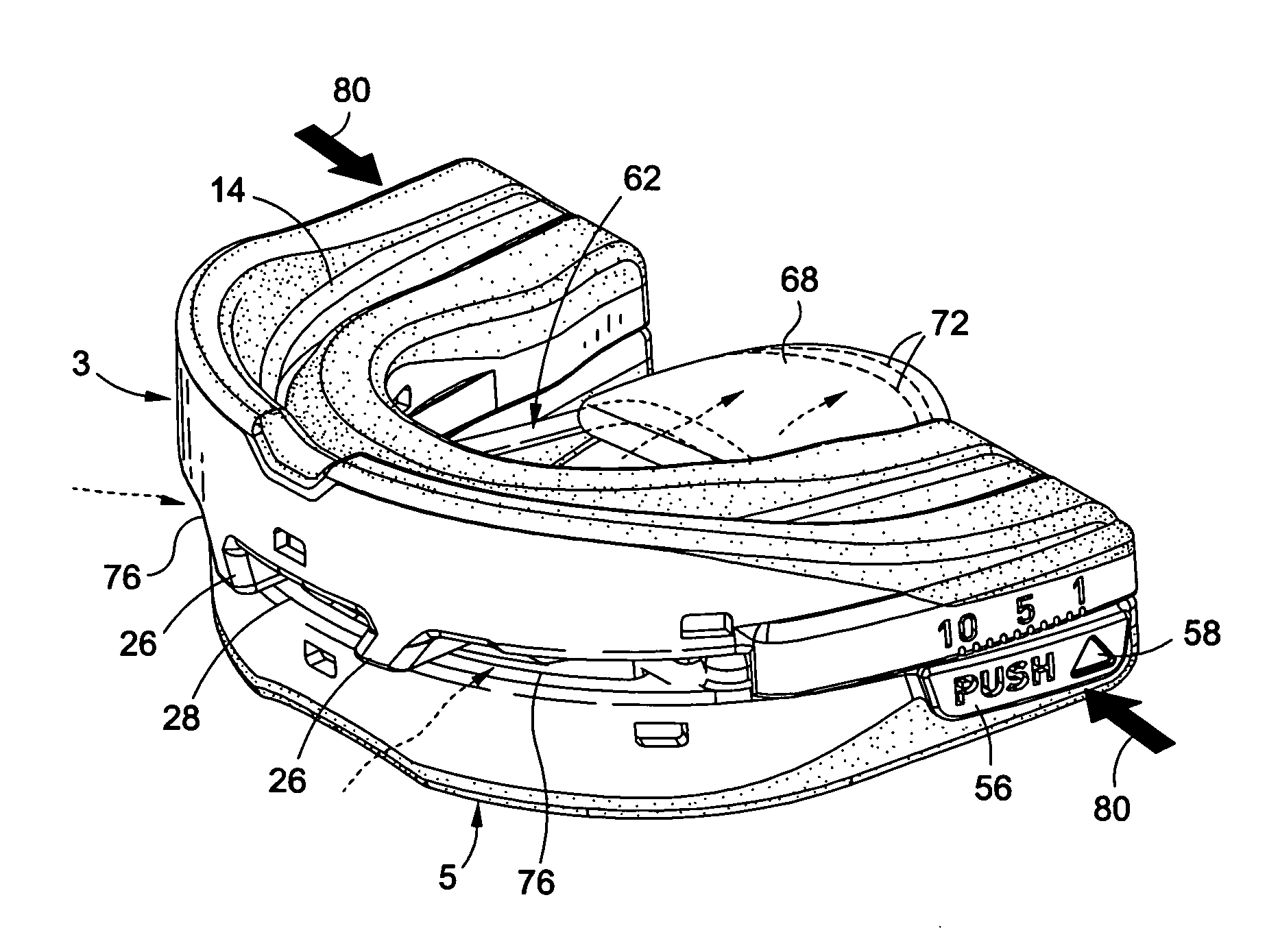 Intra-oral mandibular advancement appliance