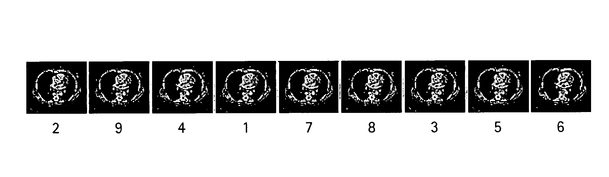 System and method for displaying images on a PACS workstation based on level of significance