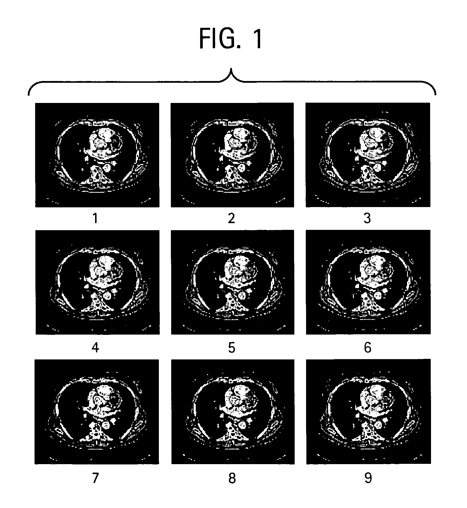 System and method for displaying images on a PACS workstation based on level of significance