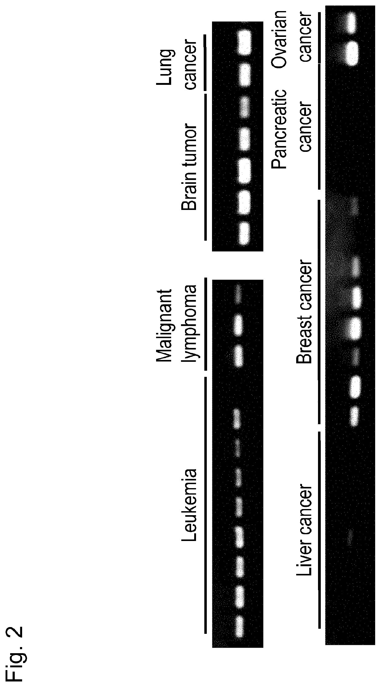 Pharmaceutical composition for treating and/or preventing cancer