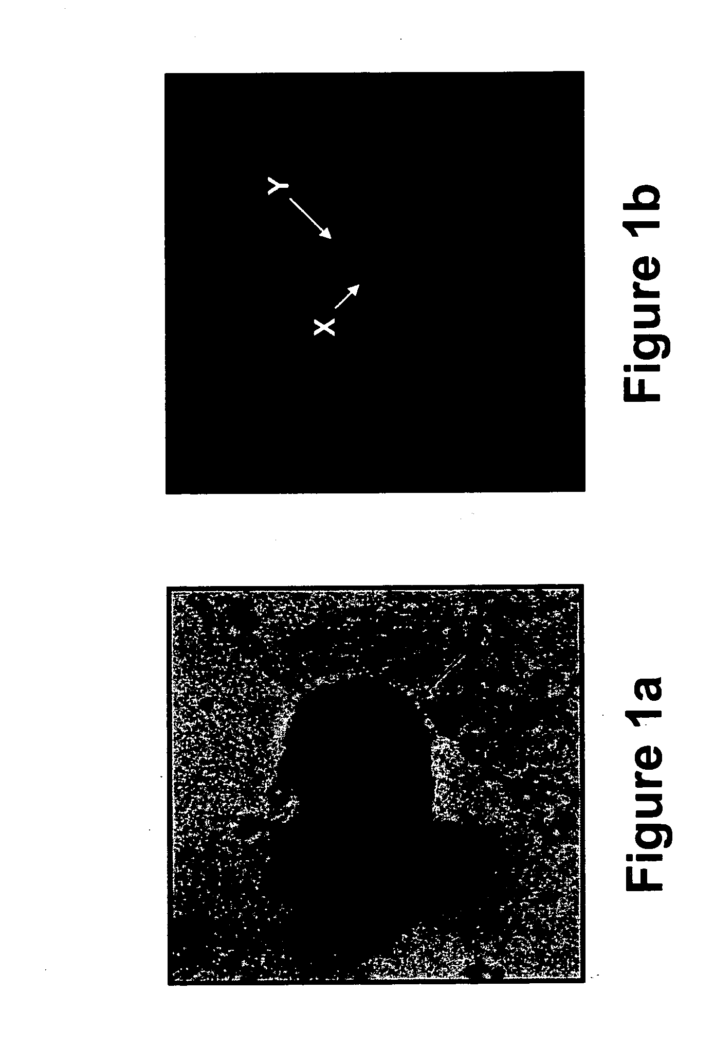 Non-invasive prenatal genetic diagnosis using transcervical cells