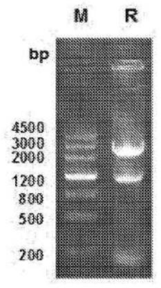 Neutralizing Anti-tl1a monoclonal antibodies