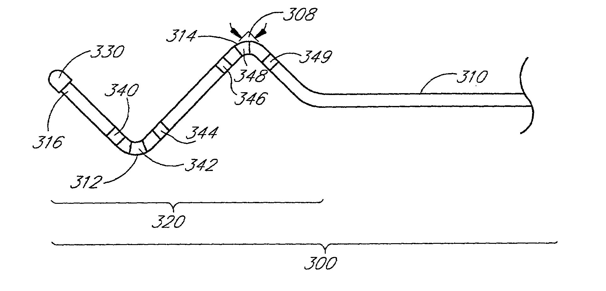 Self-anchoring coronary sinus lead