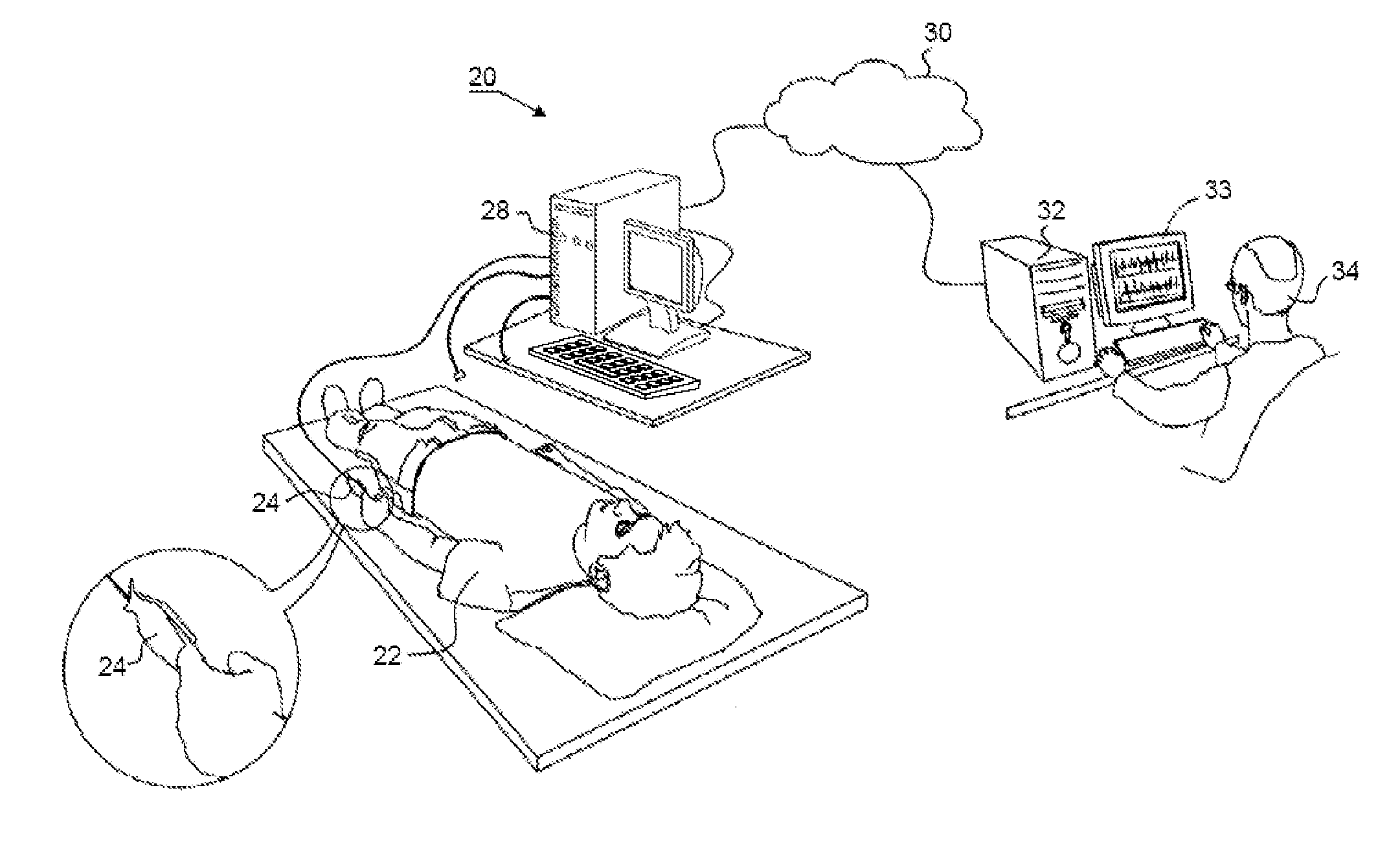 Method and system for detecting cardiac arrhythmia