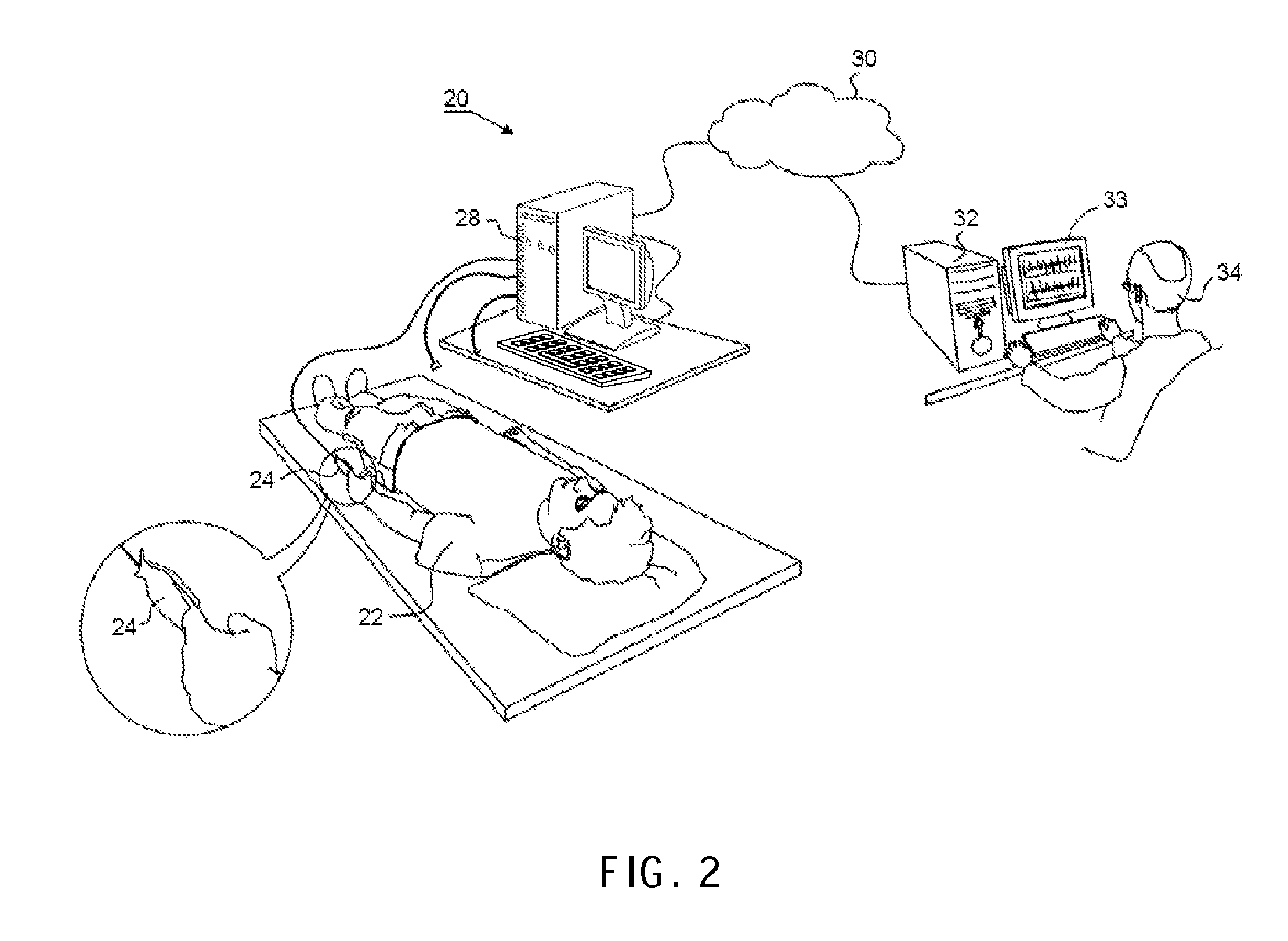 Method and system for detecting cardiac arrhythmia