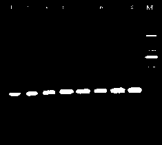 PCR (polymerase chain reaction) detection primers for three bacteria and application thereof