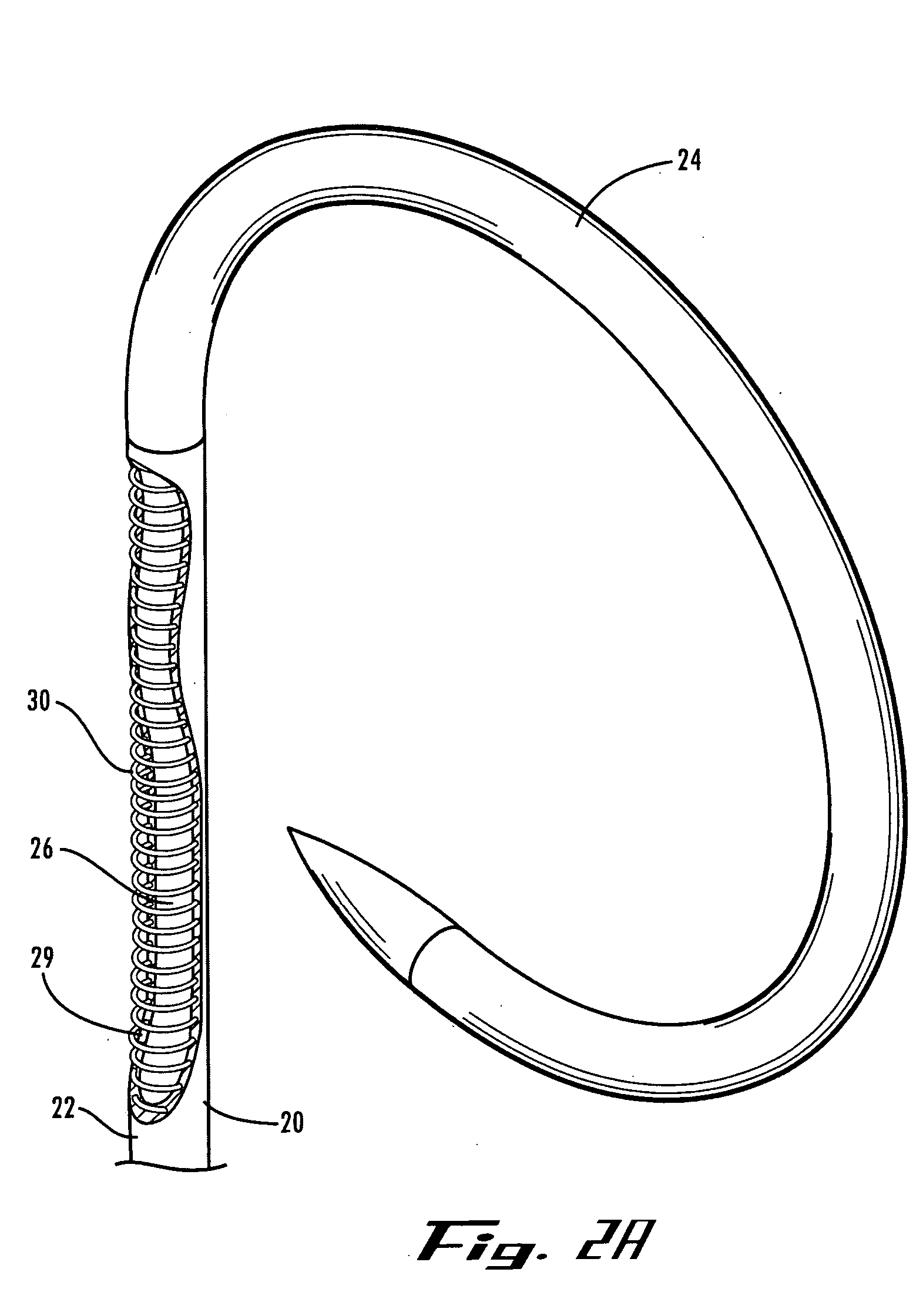 Stent improvements