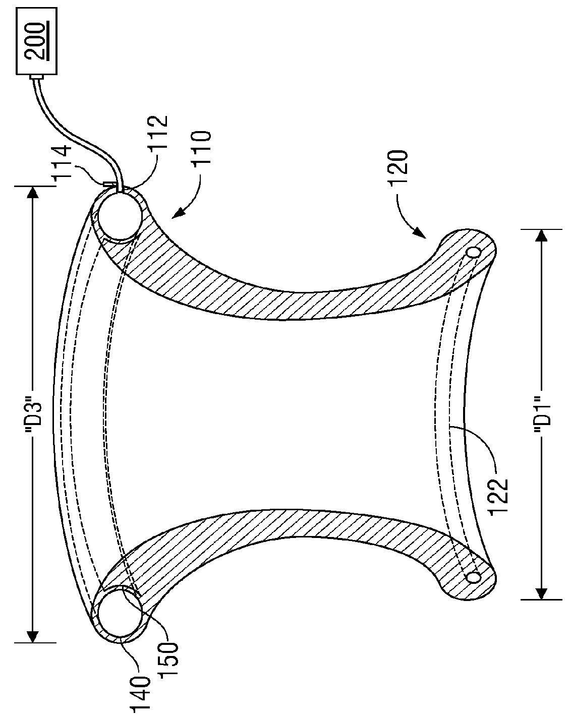 Wound retractor including rigid ring