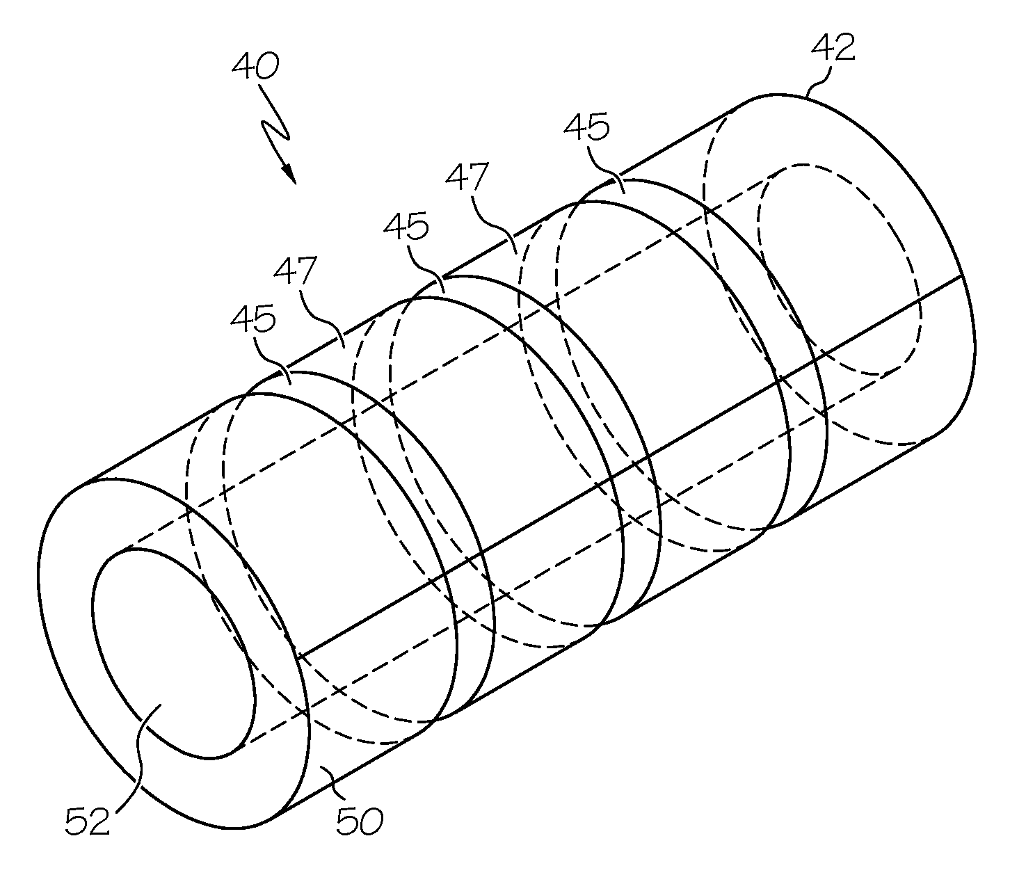 Sintered ring supported vascular graft