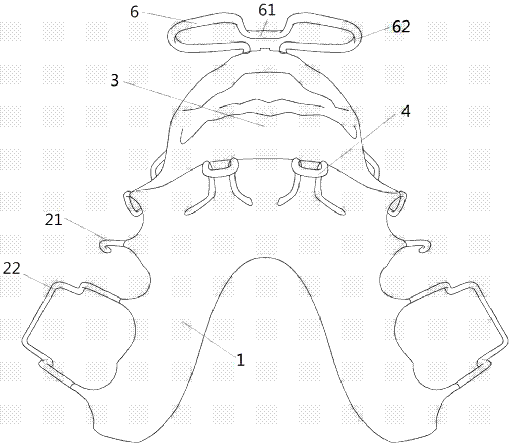 A device for guiding the mandible forward and/or breaking the bad habit of sucking the lower lip and its preparation method