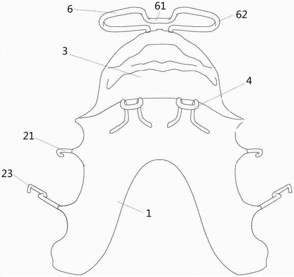 A device for guiding the mandible forward and/or breaking the bad habit of sucking the lower lip and its preparation method