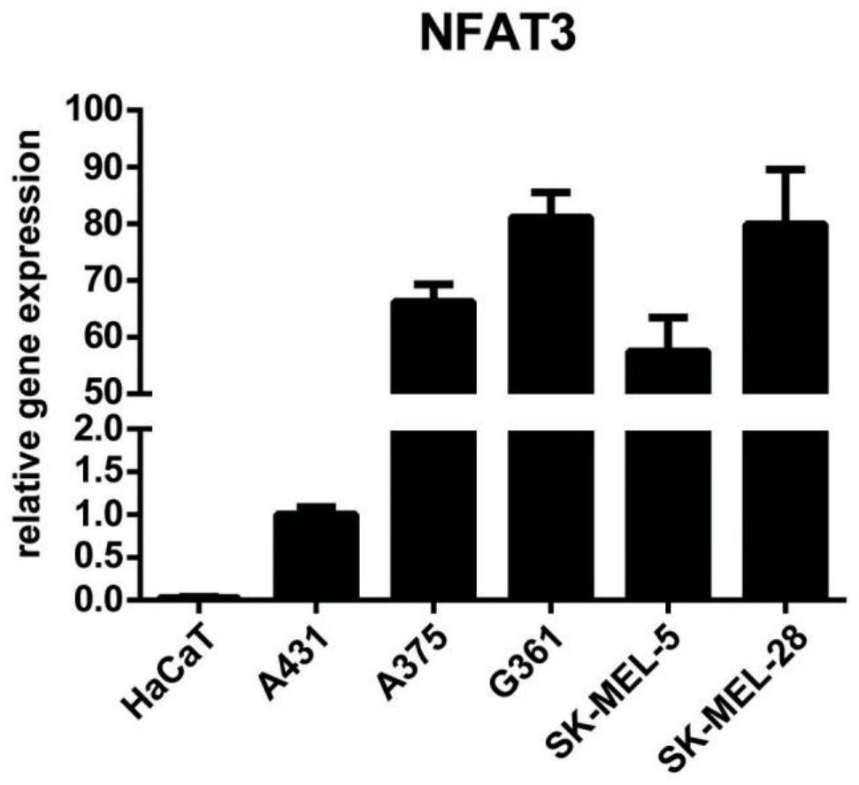 Short hairpin rna, recombinant vector and application for nfat3 gene target