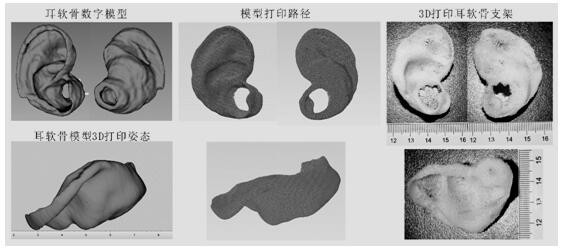 3D printed mechanical bionic auricle cartilage tissue engineering scaffold and manufacturing method thereof