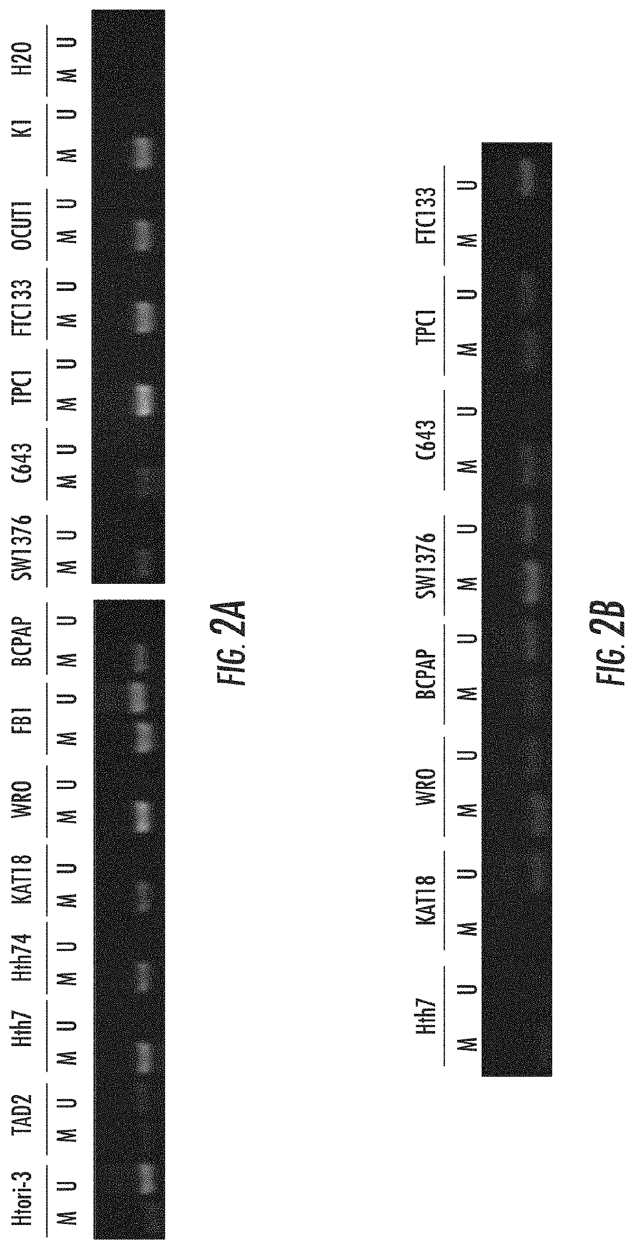 RASAL1 is a major tumor suppressor gene in thyroid cancer