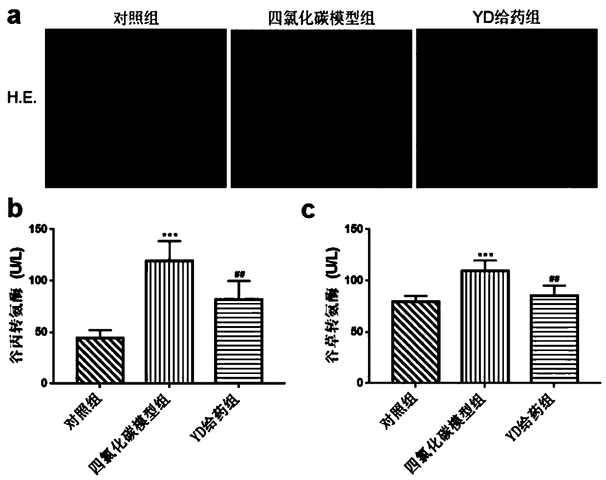 Application of antibacterial peptide YD in preparing drug for treating hepatic fibrosis