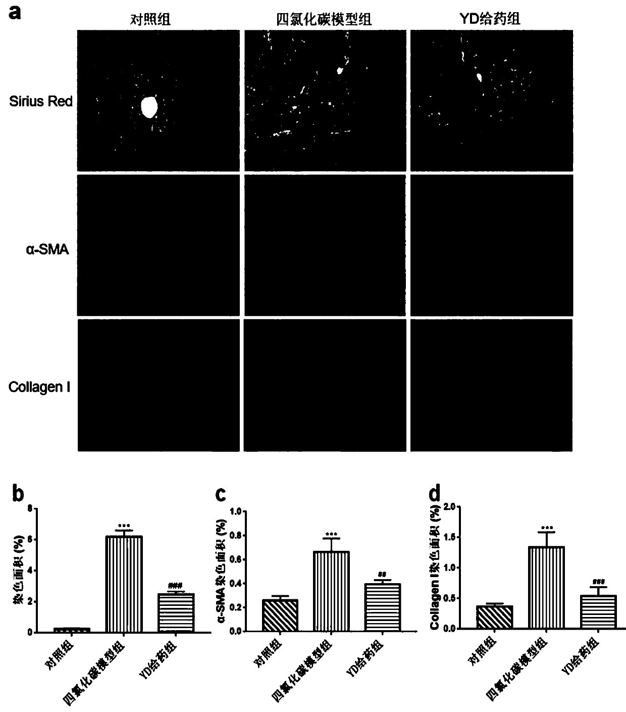 Application of antibacterial peptide YD in preparing drug for treating hepatic fibrosis