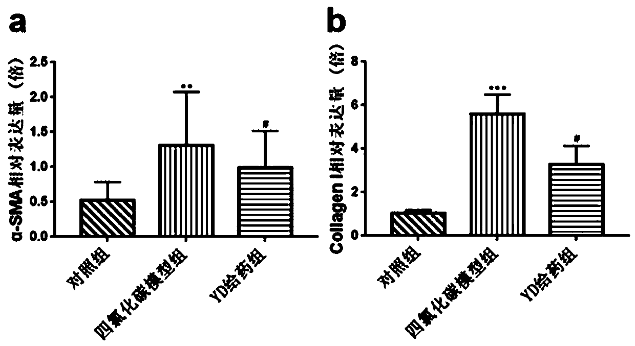 Application of antibacterial peptide YD in preparing drug for treating hepatic fibrosis