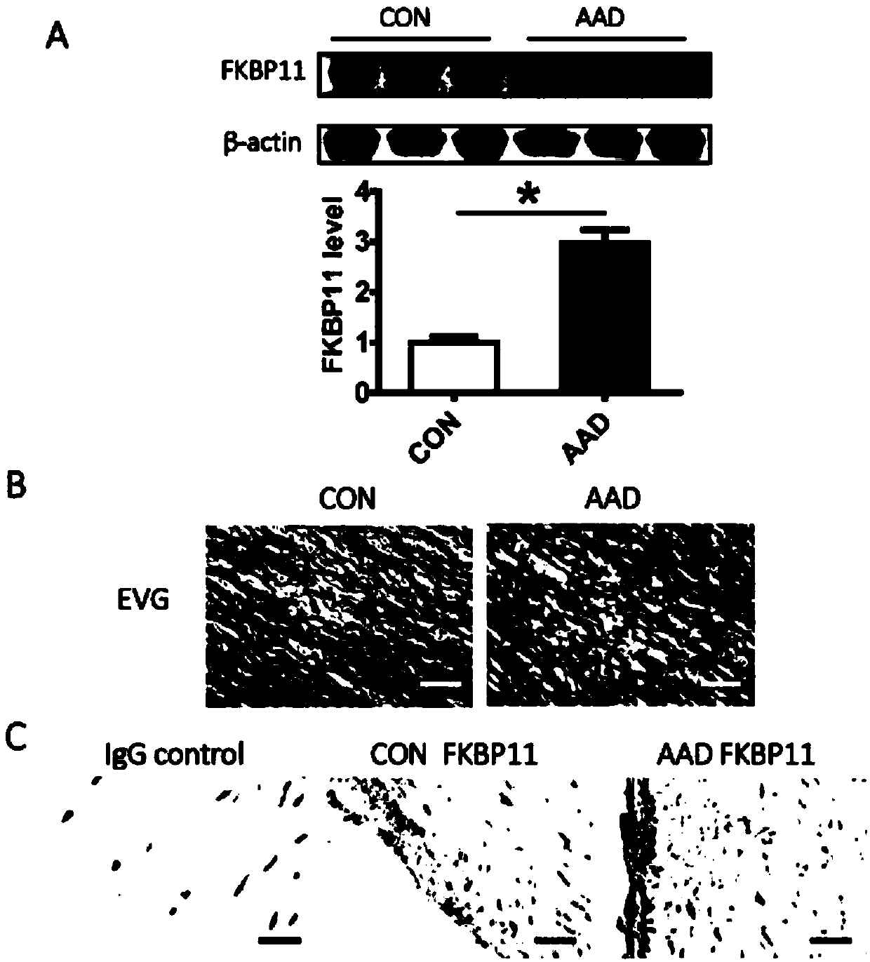 Application of FKBP11 gene in prevention and treatment of aortic dissection