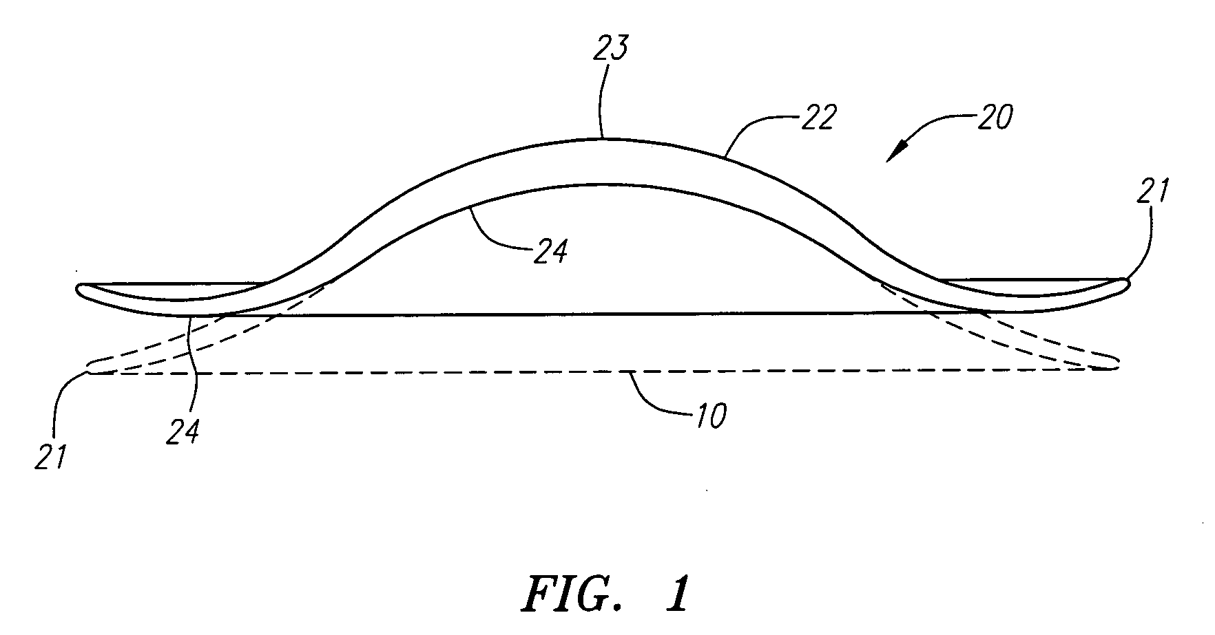 Implantable lenses with modified edge regions