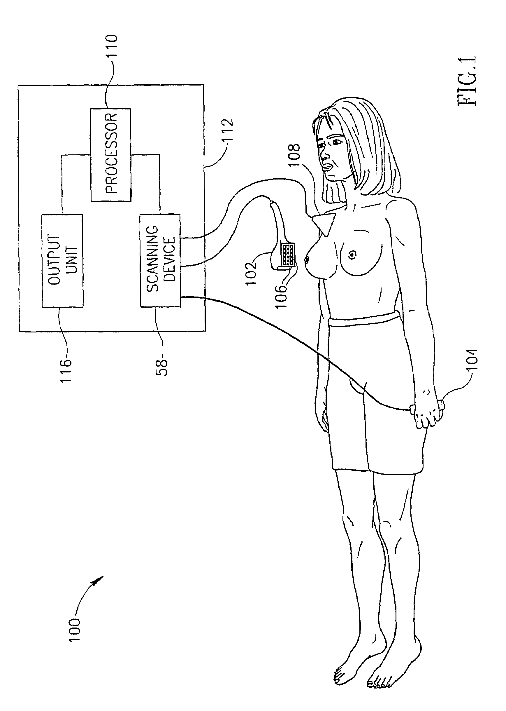 Breast cancer screening