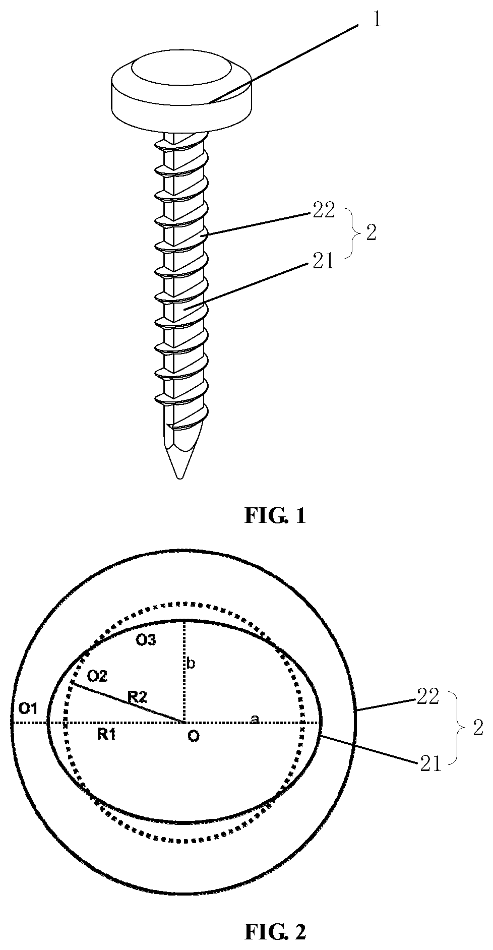 Medical anti-loosening screw based on organism osteogenesis function