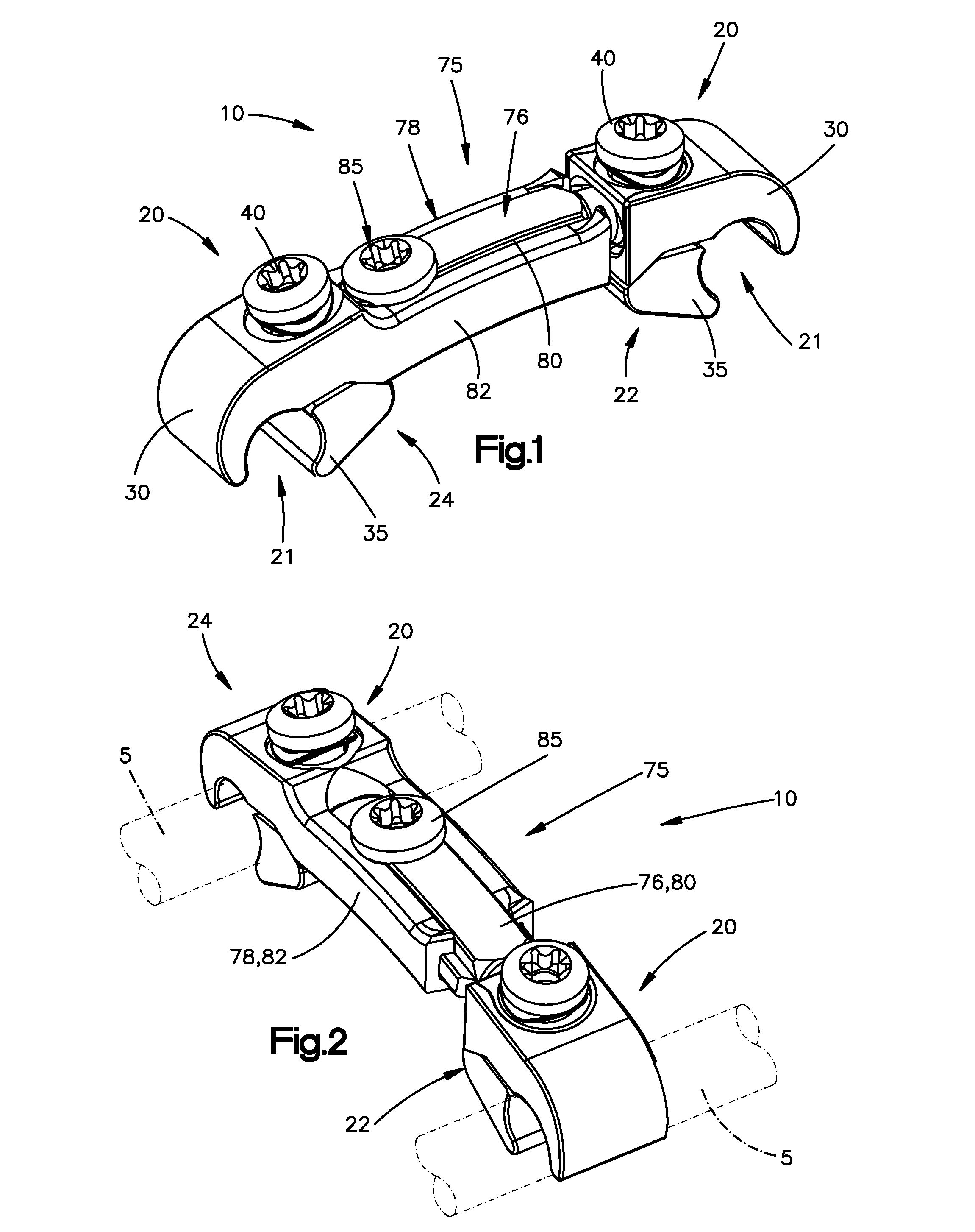 Transconnector