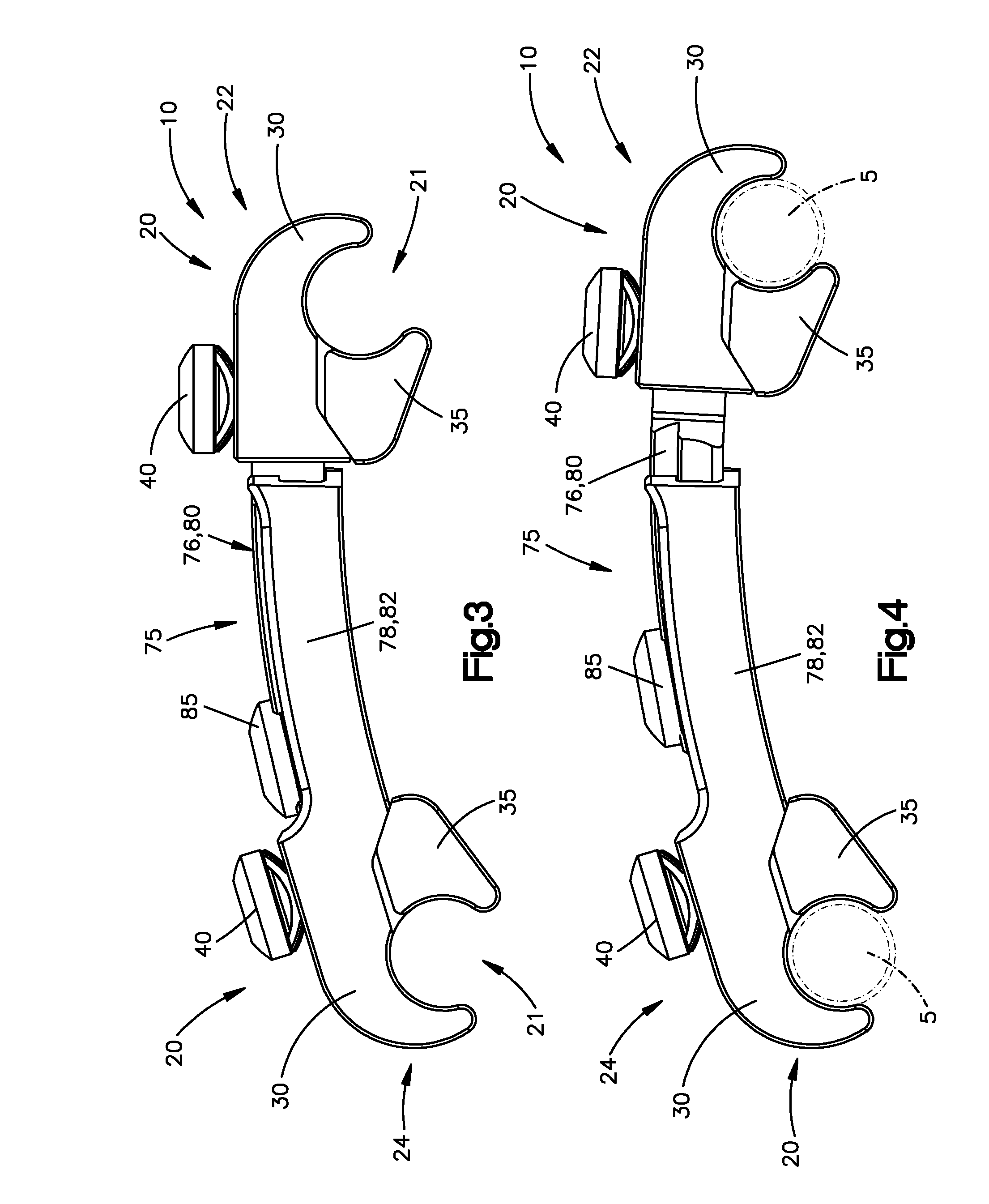 Transconnector