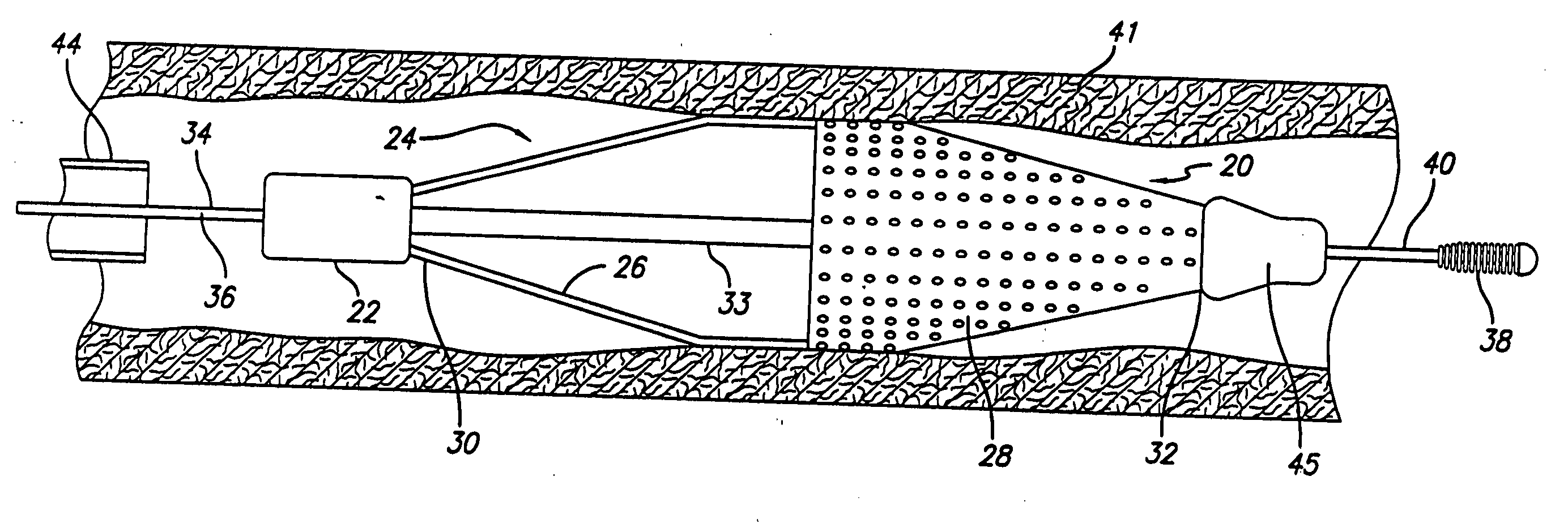 Locking component for an embolic filter assembly