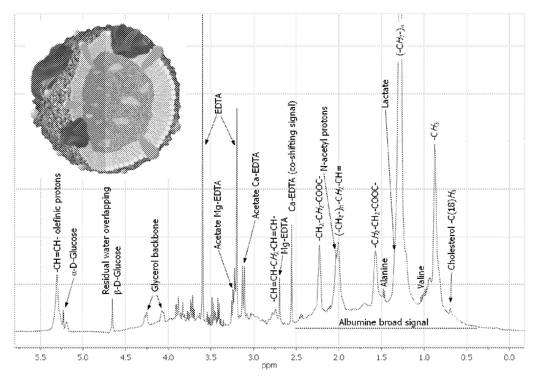 Method for prediction of lipoprotein content from nmr data